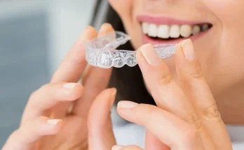 Invisalign Technology