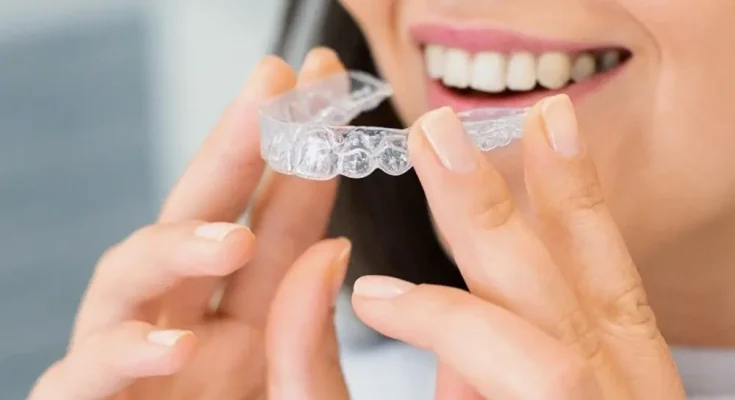 Invisalign Technology